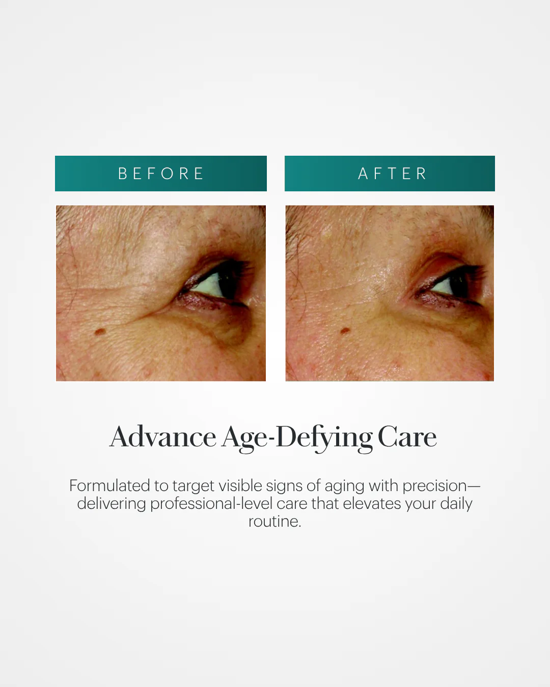 Vita Cura® Opti-Lift® Serum - Image 3